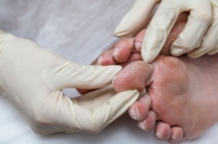 The Need for Diabetic Patients to See a Podiatrist