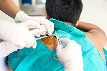skin biopsy
