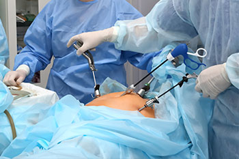 subtalar arthroscopy