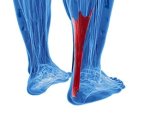 achilles tendon popping sensation