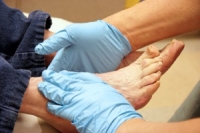 Recognizing Diabetes Symptoms in the Feet